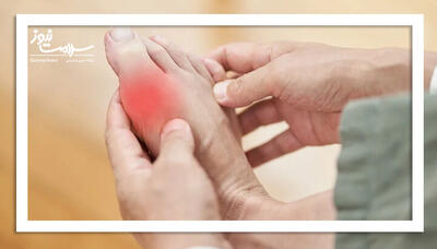 نقرس؛ بیماری مفاصل یا سبک زندگی؟ روش‌های پیشگیری و درمان این بیماری التهاب مفصلی