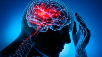 بروز سکته مغزی در مردان؛ بیش از زنان